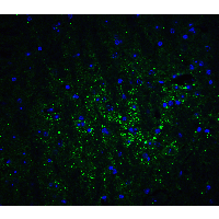 IHC-plus™ Polyclonal Rabbit anti-Human GABARAPL2 / ATG8 Antibody (IHC, IF, WB)