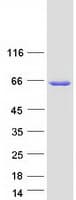 Human TMEM102 Protein (Recombinant Myc-DDK (Flag))