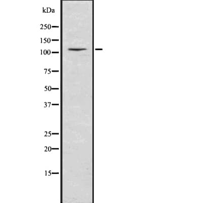 NEDD4L / NEDD4-2 Antibody