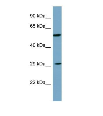 DKK1 Antibody (C-Terminus)