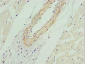 Polyclonal Rabbit anti-Human AKT1S1 / PRAS40 Antibody (IHC)