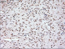 NOG / Noggin Antibody (clone OTI1H8)