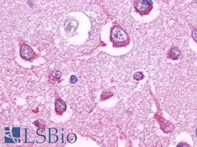 PathPlus™ HTR5A / 5-HT5A Receptor Antibody (Cytoplasmic Domain)