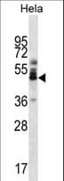 ZNF174 Antibody (aa194-222)