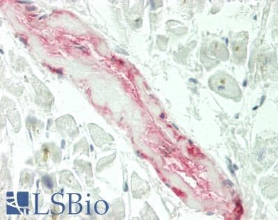 IHC-plus™ Polyclonal Rabbit anti-Human ADAMTS10 Antibody (Internal, IHC, WB)
