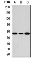 Polyclonal Rabbit anti-Human FCRL4 / IRTA1 / CD307d Antibody (WB)