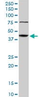IHC-plus™ ABHD5 Antibody (clone 1F3)