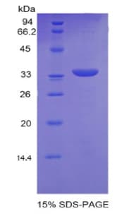 Human PNMA2 / MA2 Protein (Recombinant His)