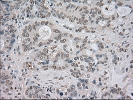 Monoclonal Mouse anti-Human NTRK3 / TRKC Antibody (clone OTI4E10, IHC, IF, WB)