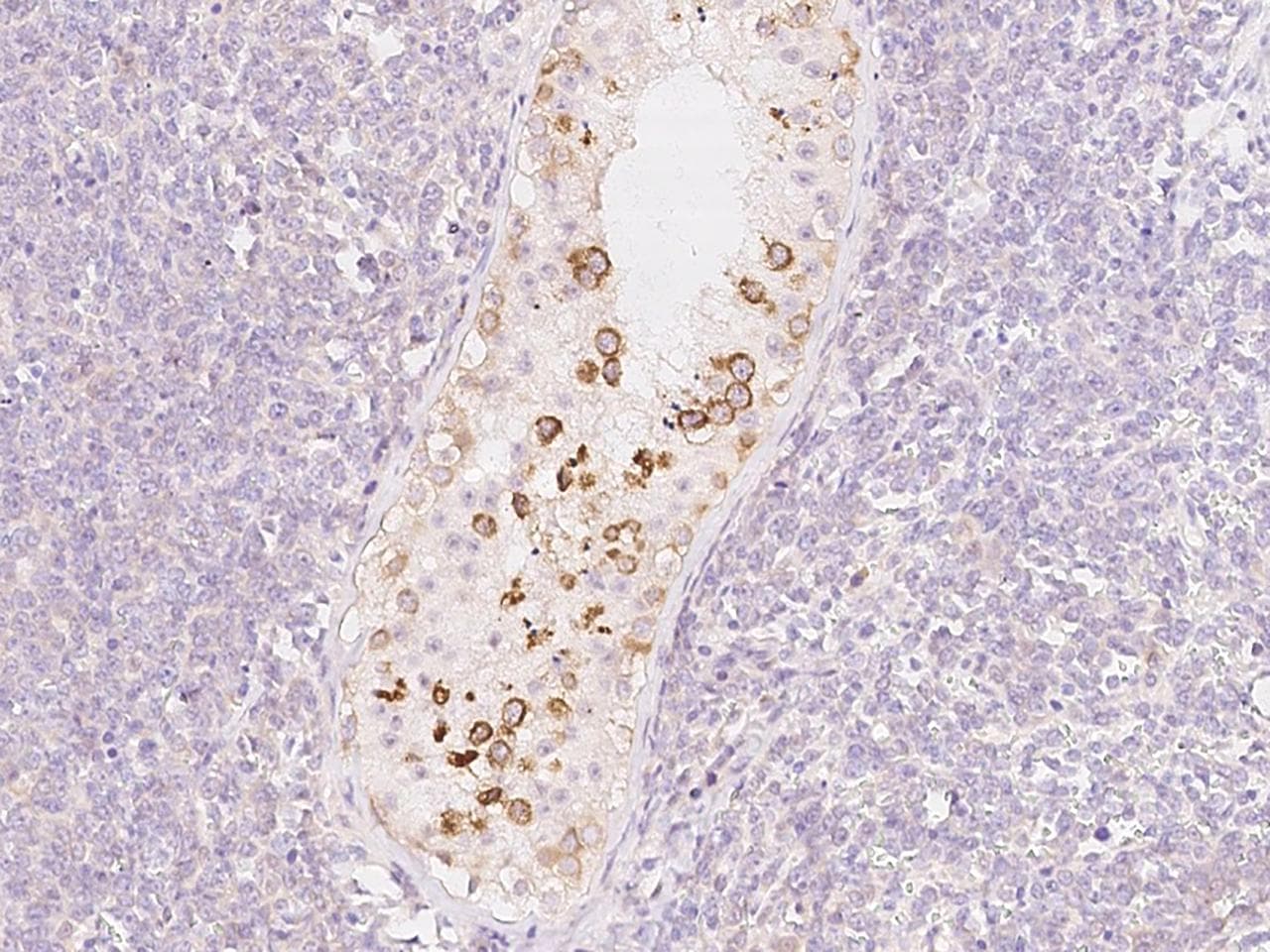 PDXDC1 Antibody