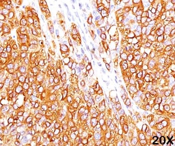 MLANA / Melan-A Antibody (clone M2-7C10, Azide-free, BSA-free)