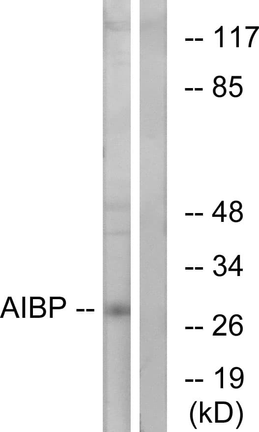 APOA1BP Antibody (aa121-170)