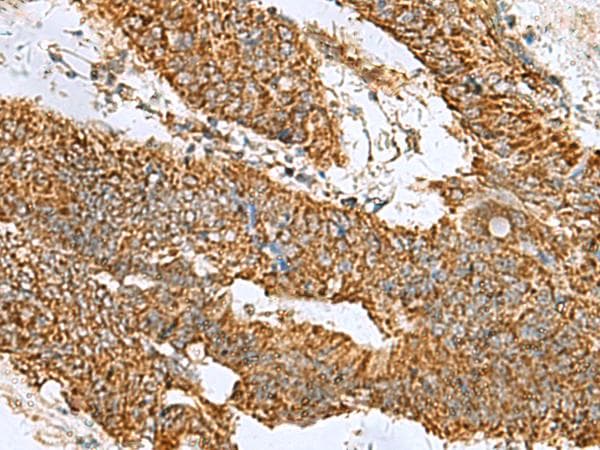 Polyclonal Rabbit anti-Human PREPL Antibody (IHC, WB)