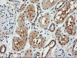 RARRES1 Antibody (clone OTI1A7)