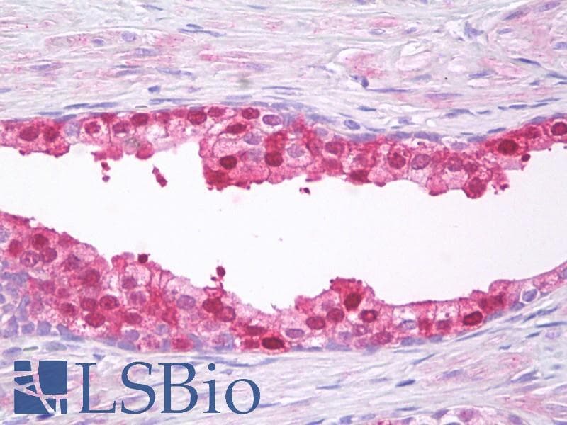 IHC-plus™ NEDF / VPS24 Antibody (Internal)