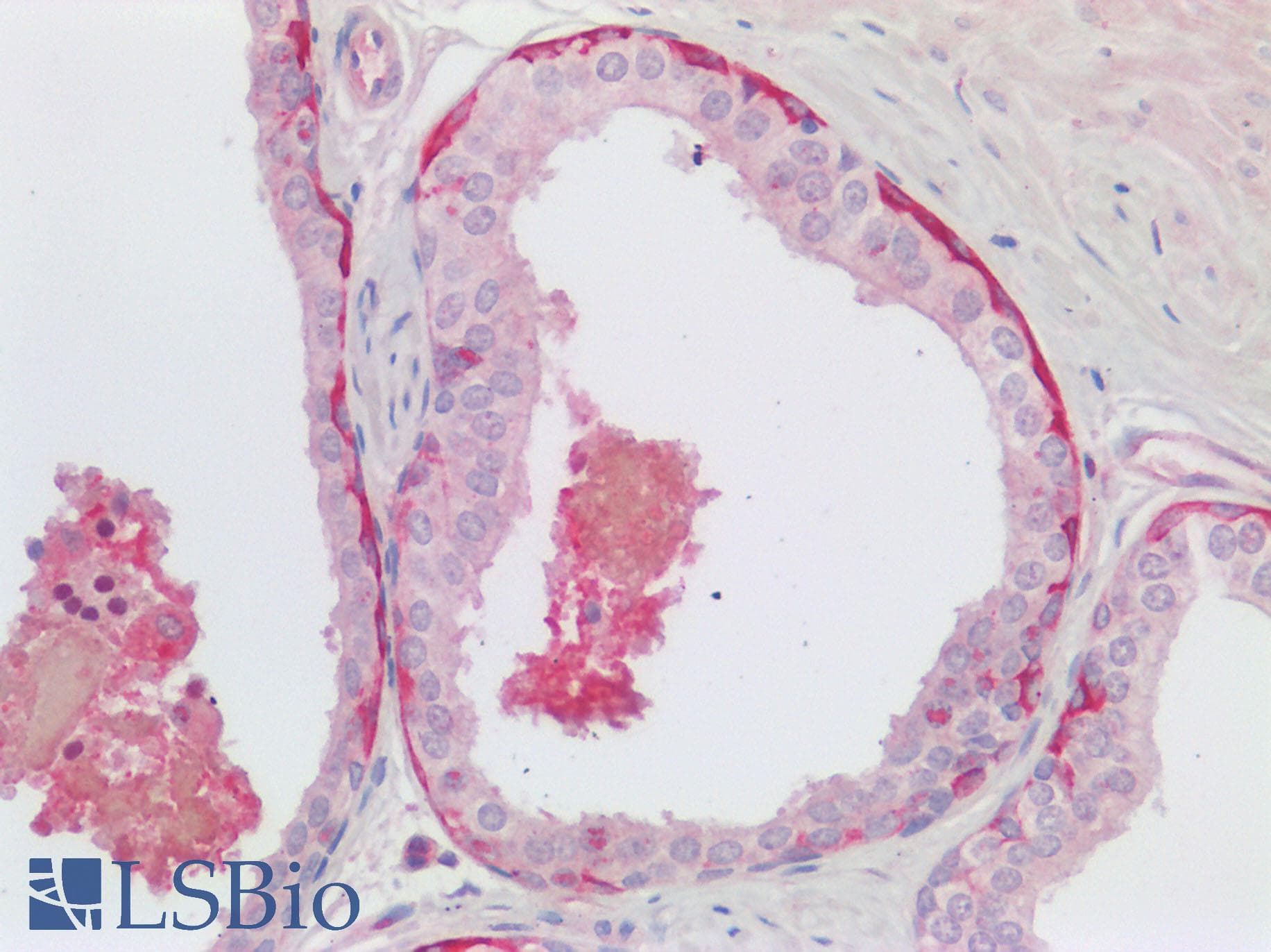 IHC-plus™ TMPRSS2 / Epitheliasin Antibody