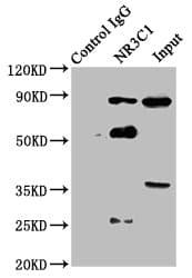Polyclonal Rabbit anti-Human NR3C1/Glucocorticoid Receptor Antibody (IHC, IF, WB)