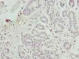 FAM71F1 Antibody