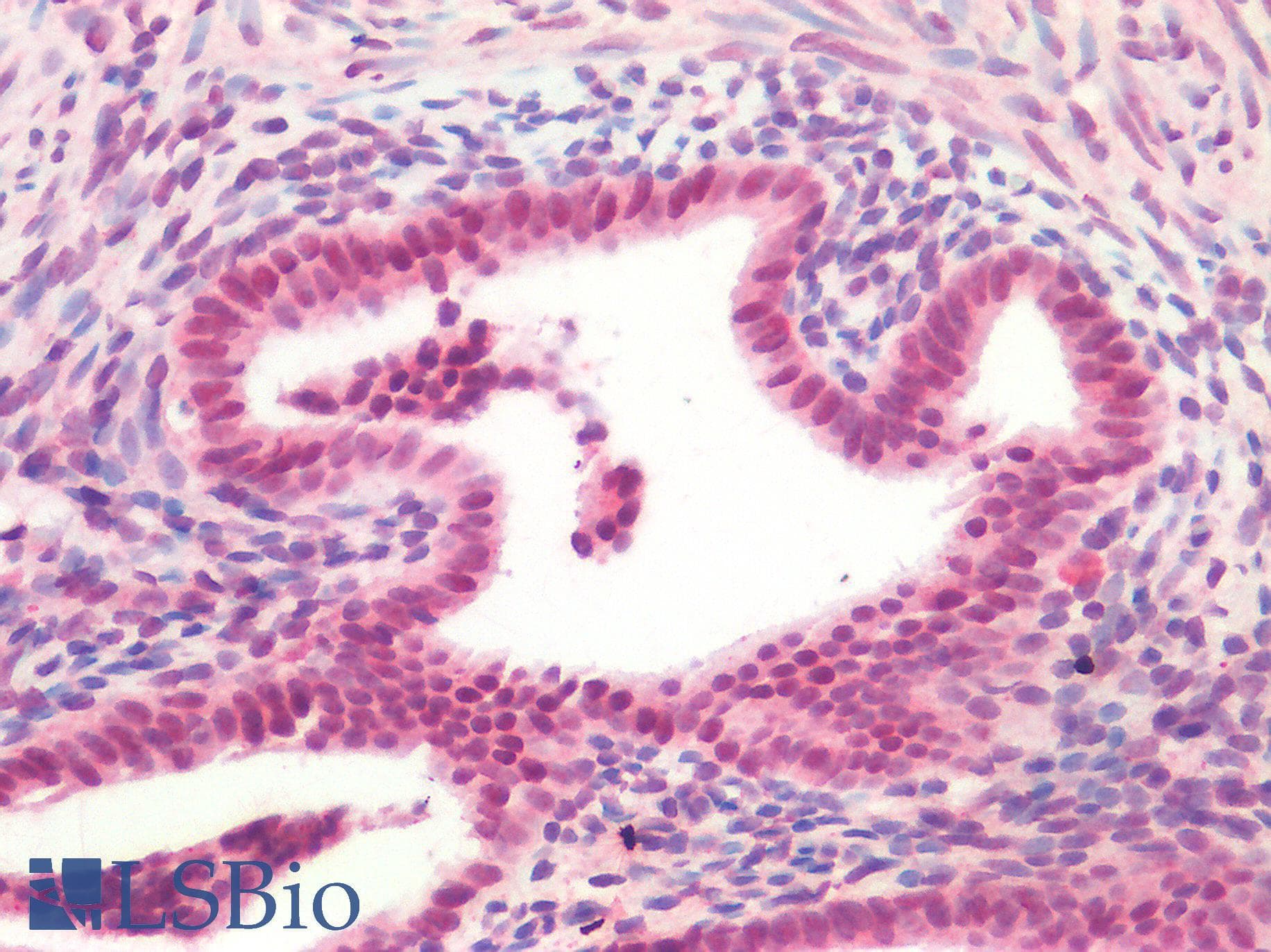 IHC-plus™ FOXC1 Antibody
