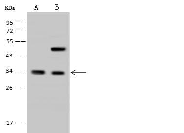 Polyclonal Rabbit anti-Human RFXANK Antibody (WB)