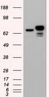 CTNNB1 / Beta Catenin Antibody (clone OTI1F3)