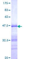 Human ETV5 / ERM Protein (Recombinant GST, N-terminus)