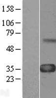 CCN4 / WISP1 Protein (Over-Expression Lysate Myc-DDK (Flag))