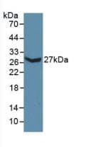 COL3A1 / Collagen III Antibody (aa434-643)