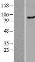 TLR6 Protein (Over-Expression Lysate Myc-DDK (Flag))