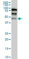 IHC-plus™ YAP / YAP1 Antibody (clone 2H1)