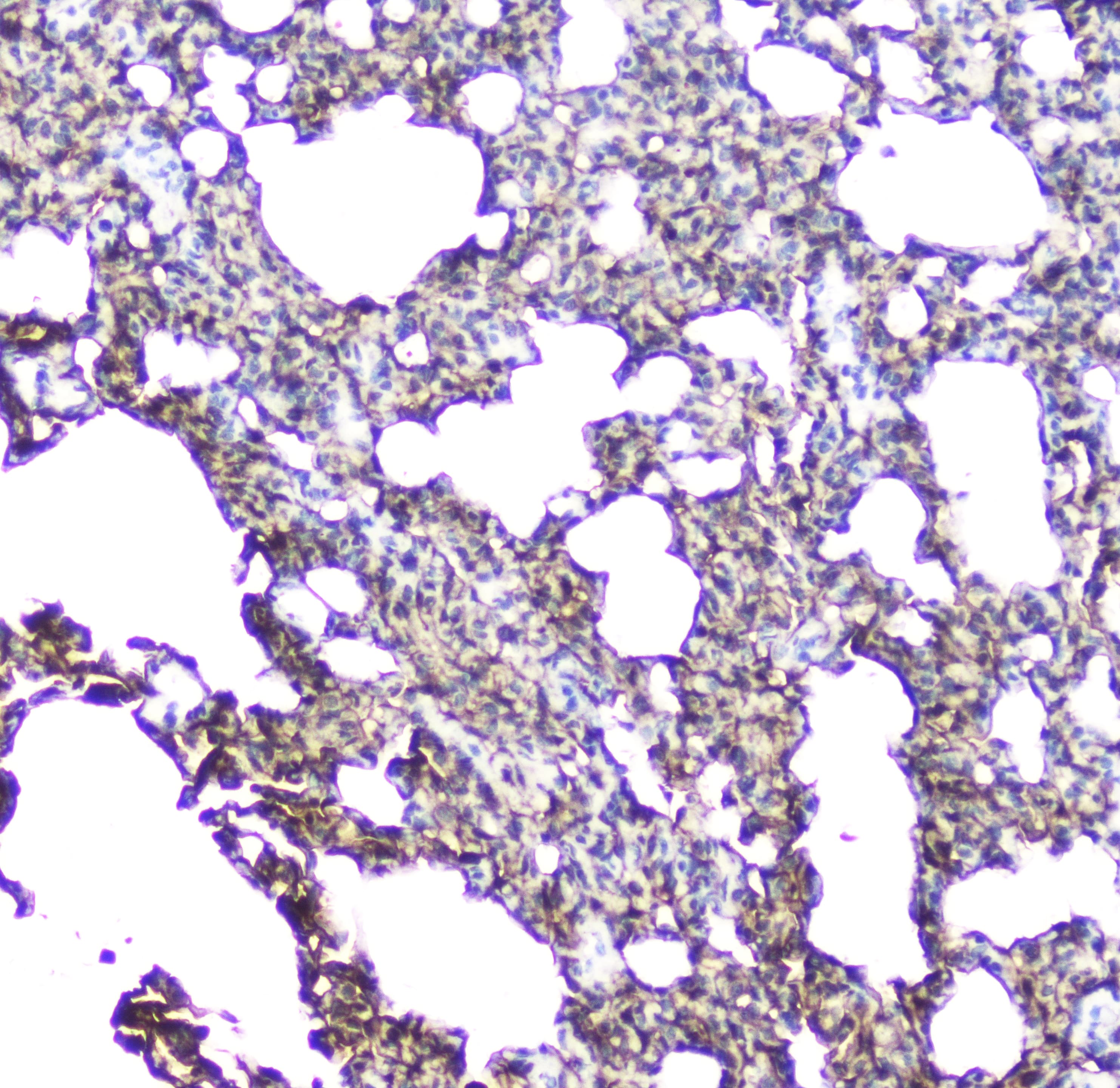 Polyclonal Rabbit anti-Human AQP5 / Aquaporin 5 Antibody (IHC, WB)