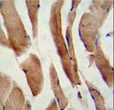 Polyclonal Rabbit anti-Human CFLAR / FLIP Antibody (aa145-174, IHC, WB)