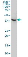 NODAL Antibody (clone 5C3)