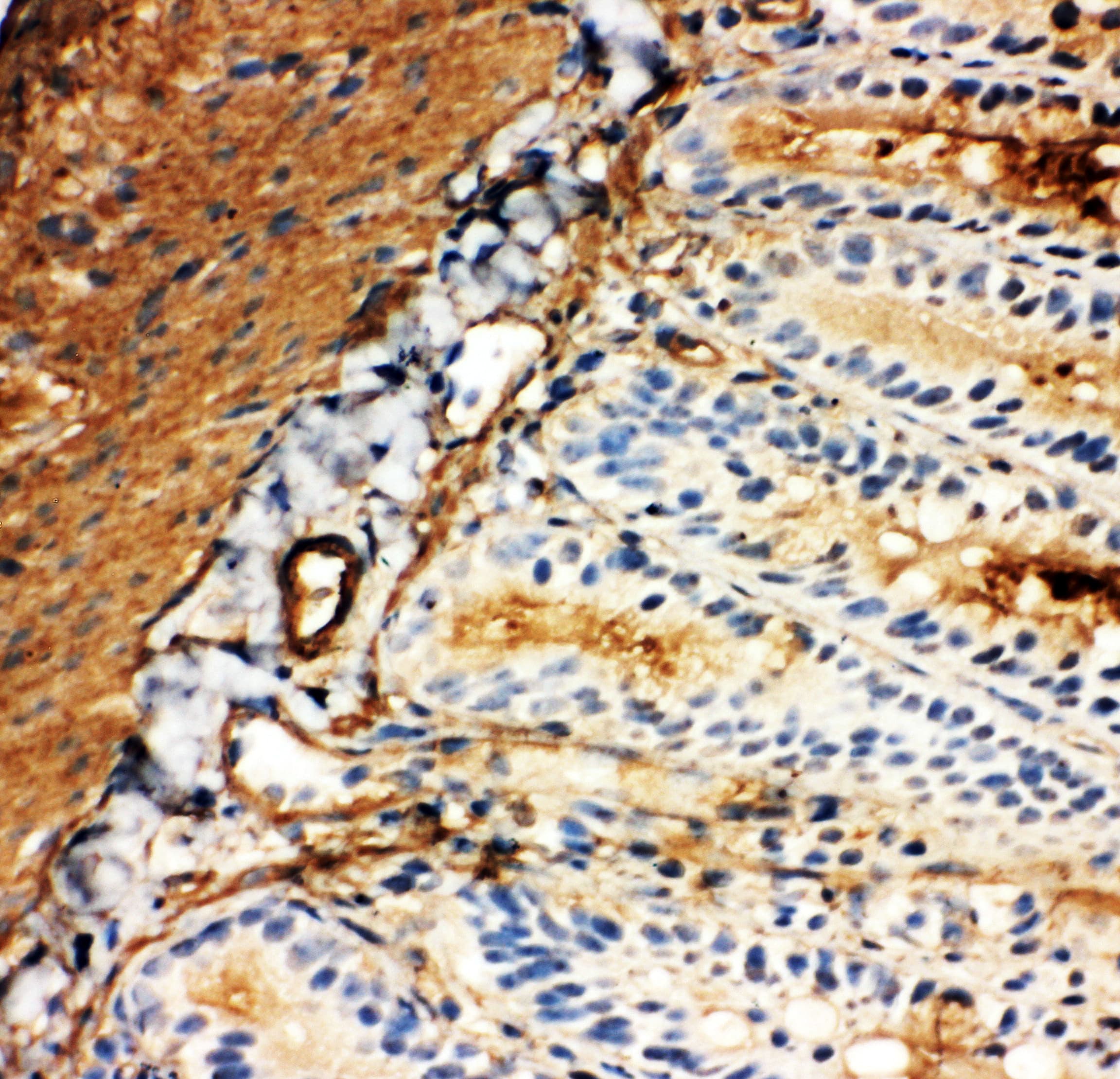 Polyclonal Rabbit anti-Mouse SLC2A5 / GLUT5 Antibody (aa232-251, IHC, WB)