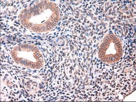 KRT18 / CK18 / Cytokeratin 18 Antibody (clone OTI5E8)