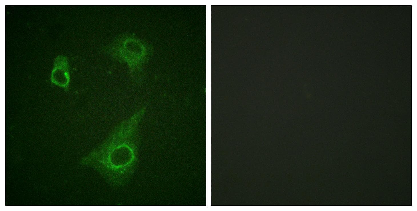 EPOR / EPO Receptor Antibody (phospho-Tyr368)