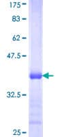 Human ACSL3 Protein (Recombinant GST, N-terminus)
