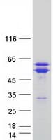 Human TACC1 Protein (Recombinant Myc-DDK (Flag))