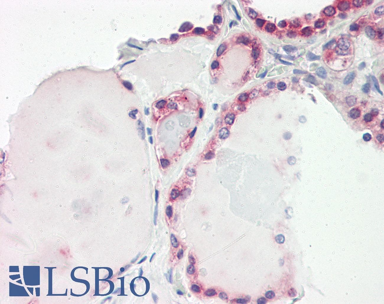 Polyclonal Rabbit anti-Human LEREPO4 / ZC3H15 Antibody (aa290-339, IHC, WB)