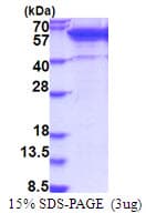 Human ETS2 Protein (Recombinant His)