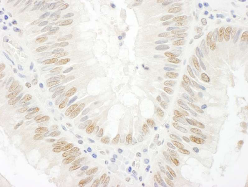 Polyclonal Rabbit anti-Human BCCIP Antibody (aa300-350, IHC, IF)