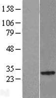NKIRAS2 Protein (Over-Expression Lysate Myc-DDK (Flag))