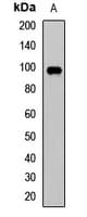 NFAT1 / NFATC2 Antibody