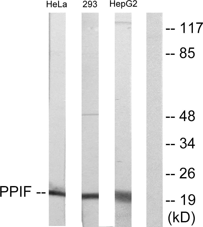 IHC-plus™ Polyclonal Rabbit anti-Human PPIF / Cyclophilin F Antibody (aa86-135, IHC, WB)