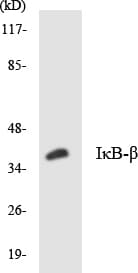 NFKBIB / IKB Beta / IKBB Antibody (aa13-62)