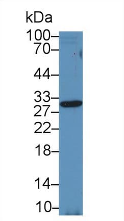 TIMP2 Antibody (aa2-88)