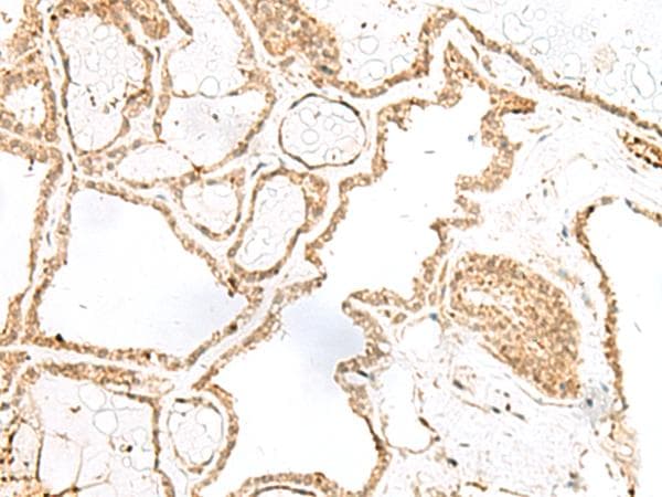 RPP14 Antibody