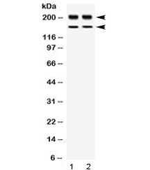 Polyclonal Rabbit anti-Human WRN Antibody (WB)