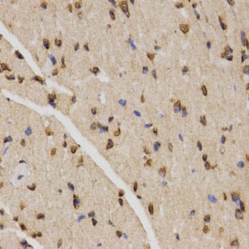Polyclonal Rabbit anti-Human Histone H4 Antibody (Tri-Methyl-Lys20, IHC, IF, WB)