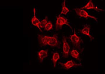 NDRG3 Antibody